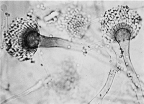 Aspergillus Fumigatus (Küf mantarı)