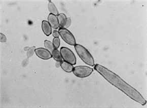 Cladosporium (Küf mantarı)